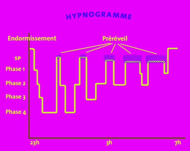 hypnodossier