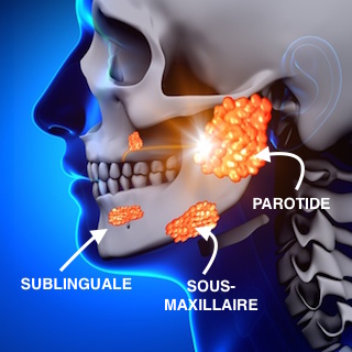 Glandes salivaires: des infections, des calculs – Mongeneraliste ...